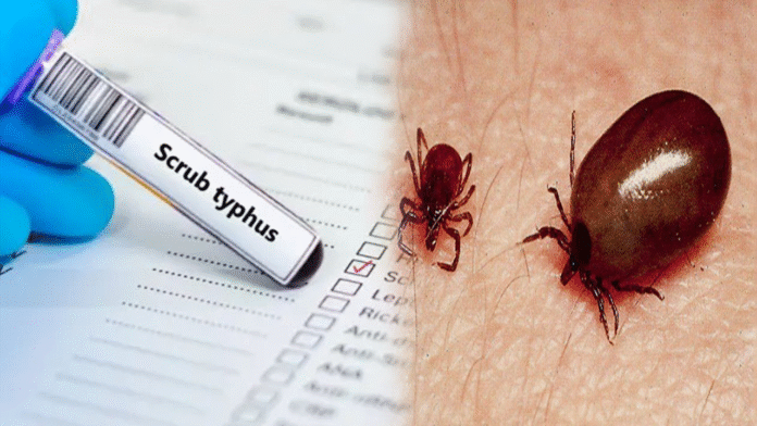 “ఆంధ్రప్రదేశ్‌లో స్క్రబ్ టైఫస్ కేసులు పెరుగుతున్న నేపథ్యంలో ఆరోగ్య సిబ్బంది జ్వరం బాధితులను పరీక్షిస్తున్న దృశ్యం”